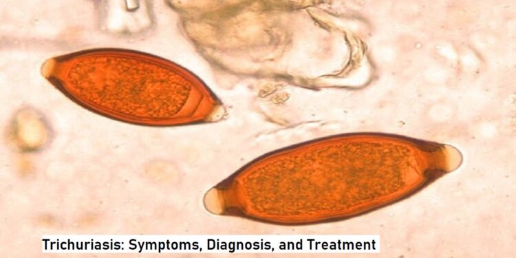 Trichuriasis